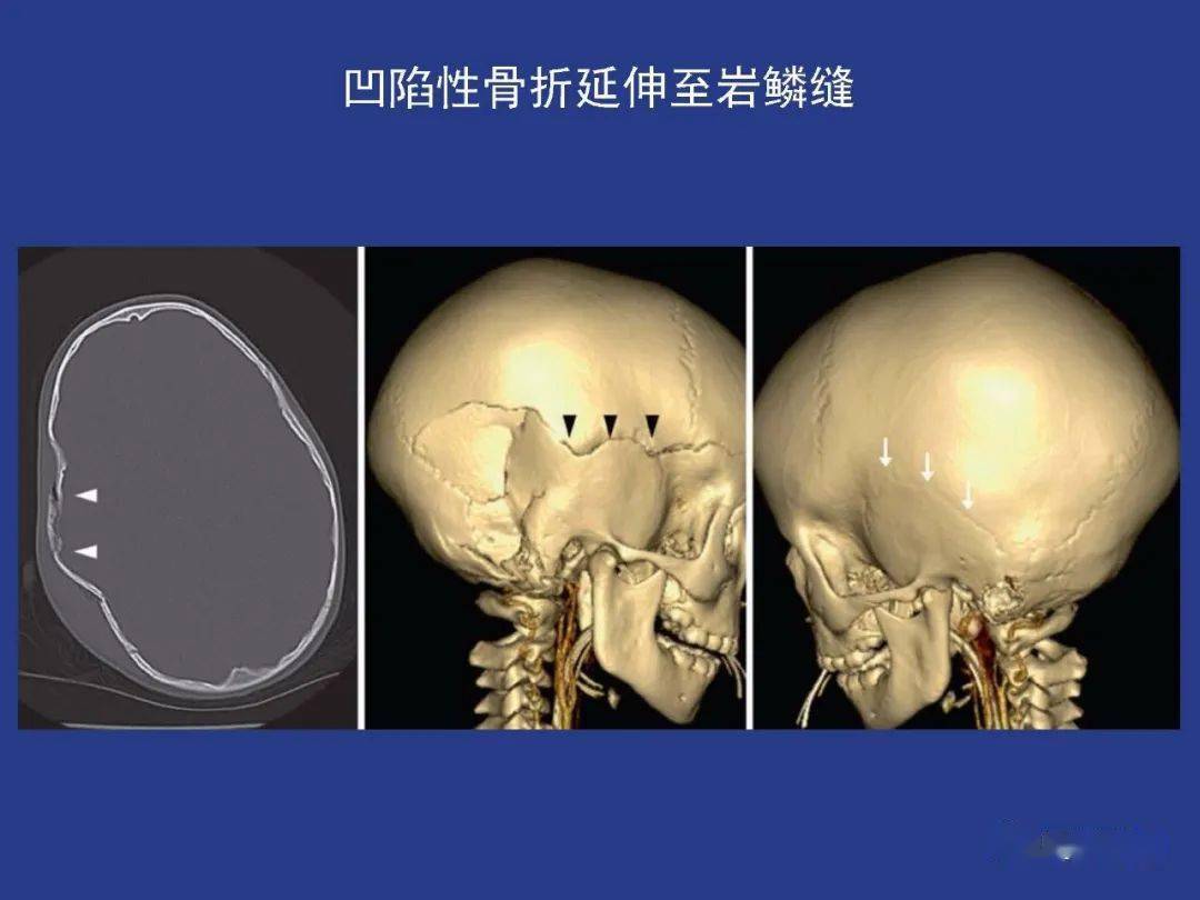 正常头骨 搜狗图片搜索