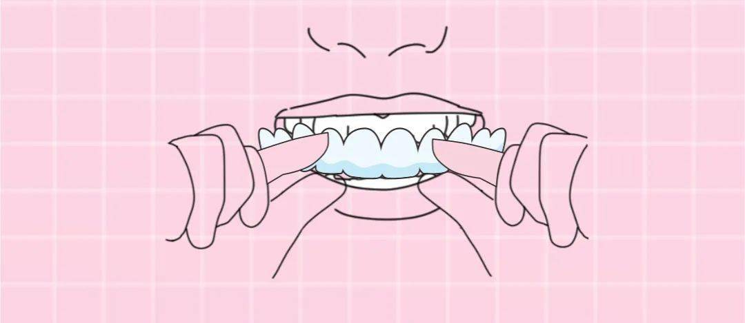 杭州征集100名牙齿不齐市民,隐形矫正低至9900!