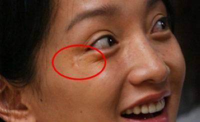 本来说,眉毛是看兄弟姐妹的宫位, 为什么眉毛有疤痕也会影响感情呢?