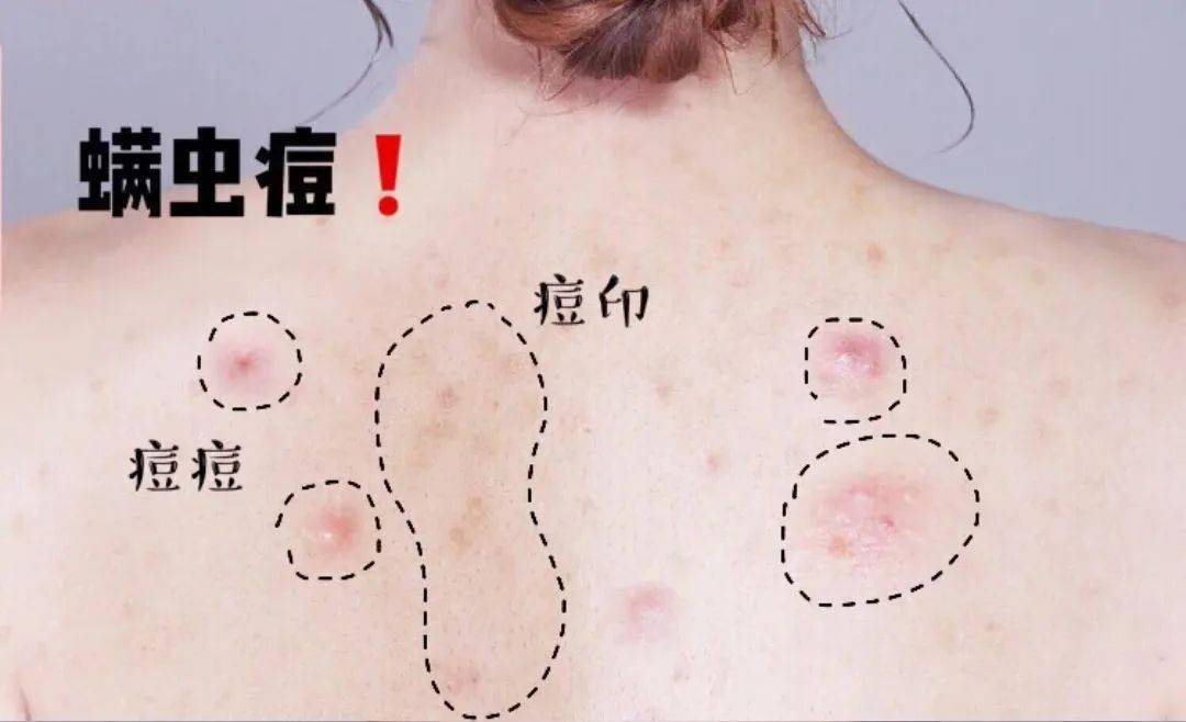人口怎么洗_人口普查绘画怎么画