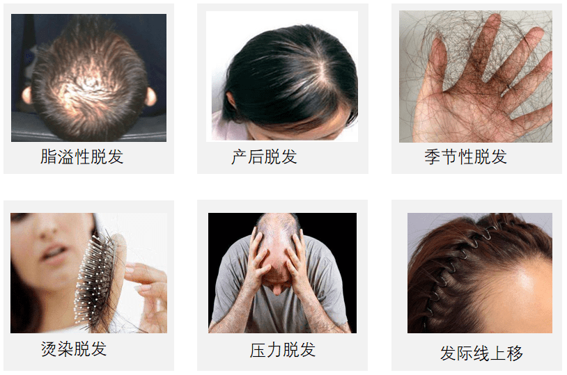 4c70f0f5c56743cbae7303b650ea5509.png