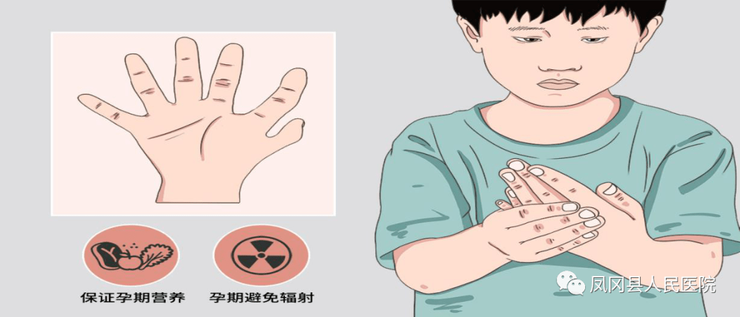 关爱儿童健康多指并指趾畸形什么时候手术最佳