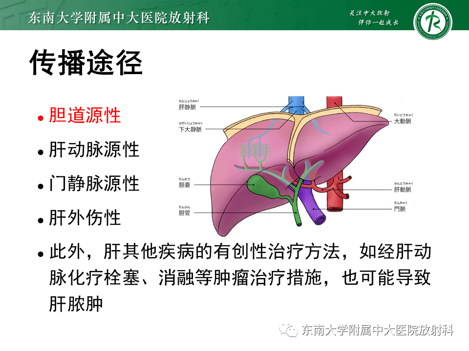 细菌性肝脓肿_解剖