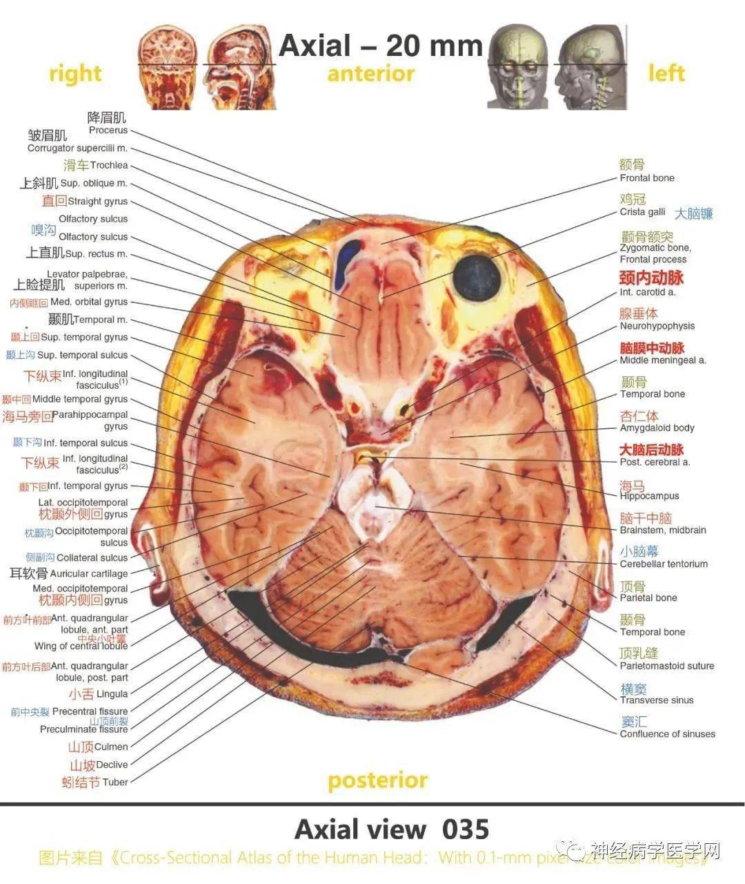 颅脑解剖图分层图片