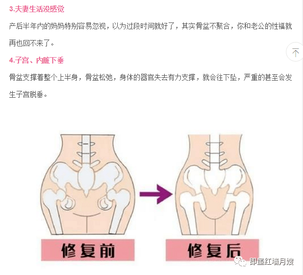 產後篇骨盆聚合需要更科學的組合搭配