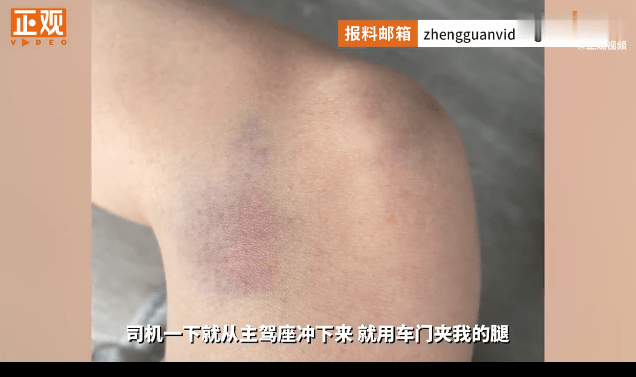嘀嗒顺风车再现司乘纠纷 女子被司机恶意关门夹伤_车主