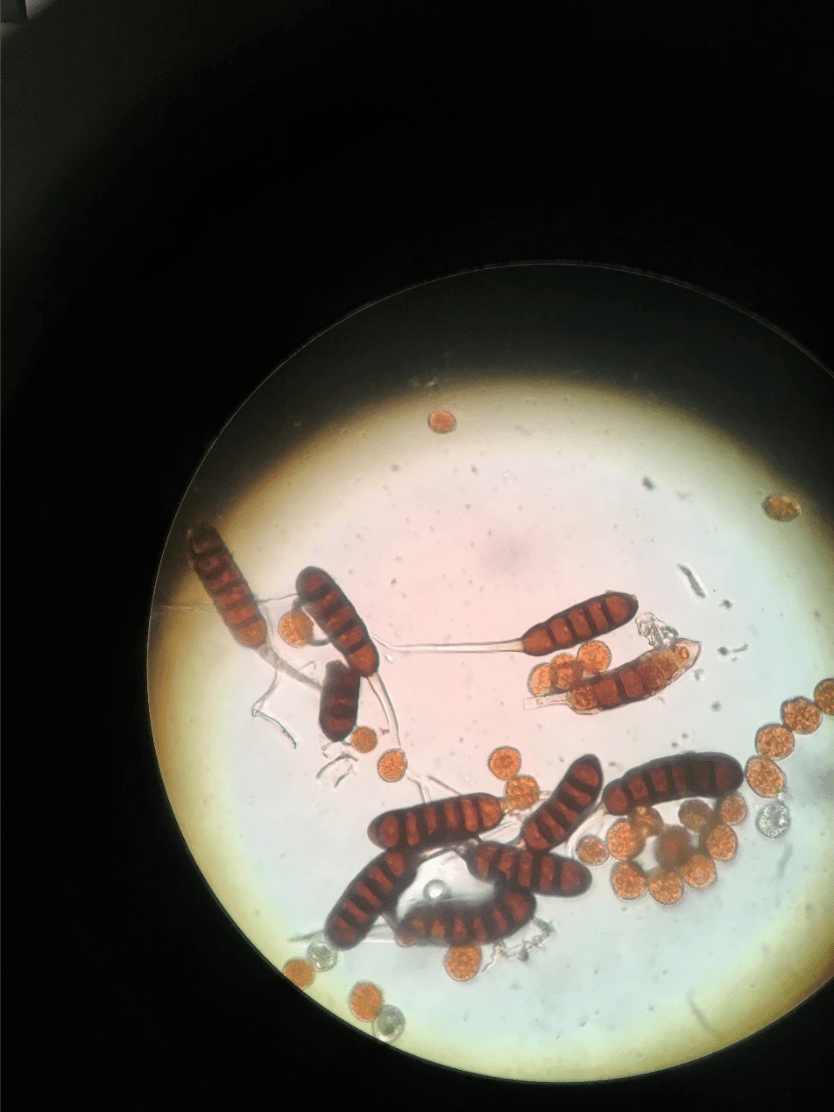 显微镜下的锈菌冬孢子和夏孢子虽是收之东隅,但也失之桑榆