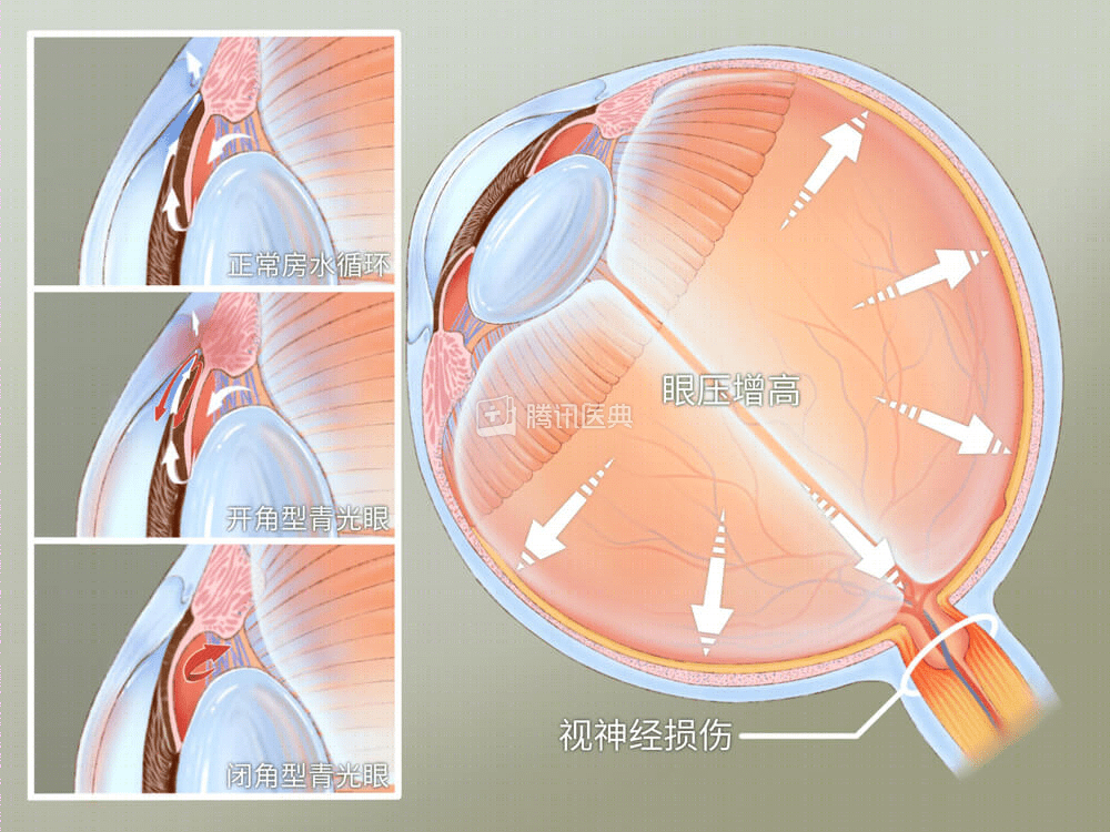 睫状肌解剖图片