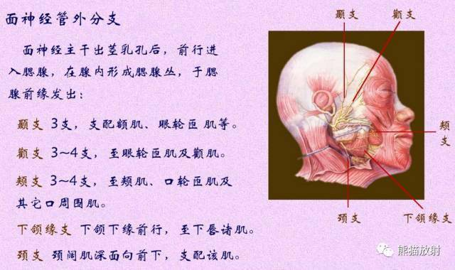 外展神經trigeminal nervev 三叉神經trochlear nerveiv 滑車神經