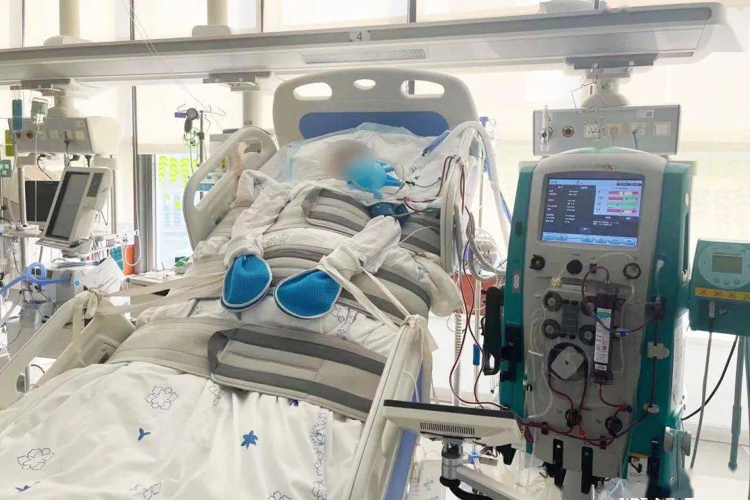 小韦在icu昏迷中