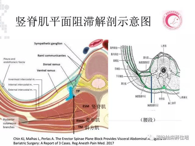 背側支通過肋橫突孔向後走行,進入豎脊肌,菱形肌和斜方肌,最終延續為