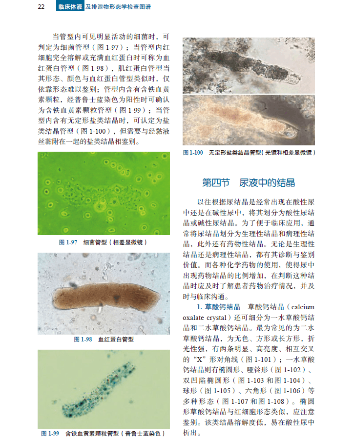 临床体液及排泄物形态学检查图谱第2版典型形态学图片助你练就火眼金