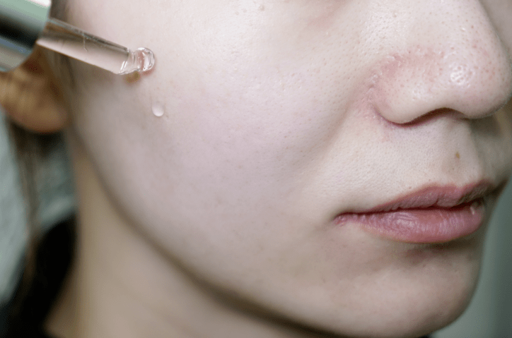 由1%水杨酸&10%烟酰胺组成的黄金浓度下的神仙cp,可是摆脱春夏"油腻"