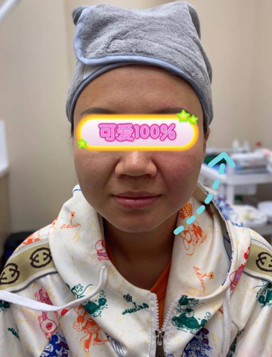 真人实测|十亿美金富婆同款fotona4d做完直呼后悔
