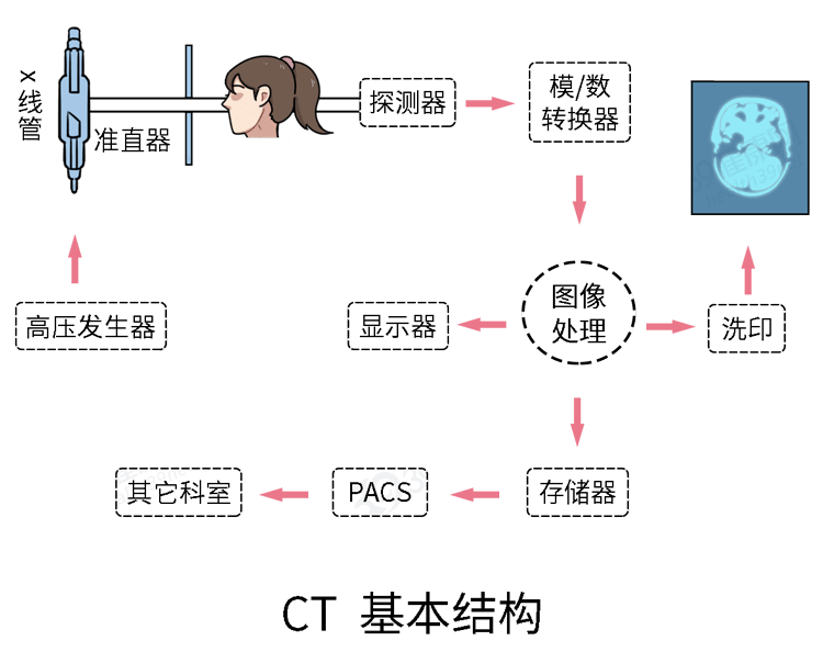 x光机透视人体原理图片