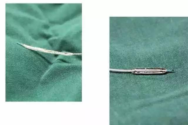 送入病变血管位置;造影完成,确定罪犯血管后,拔出造影导丝及造影导管