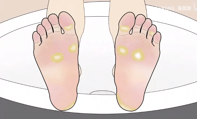 从糙脚丫到纤纤玉足你只差这一步