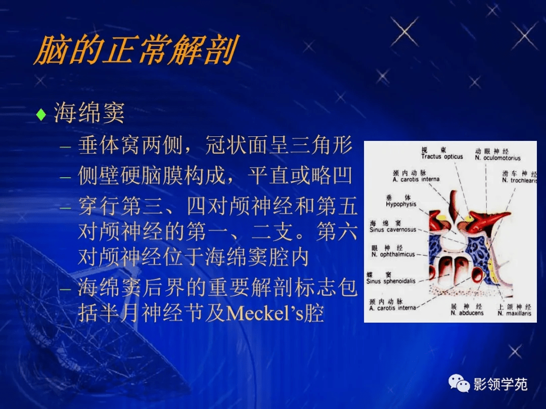 顱腦的影像解剖與常見變異