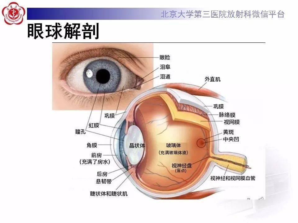 脉络膜骨瘤图片