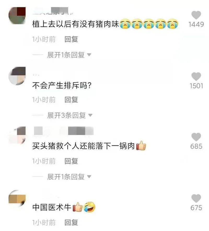 小伙96%烧伤,医院移植猪皮救命,医生:这是老技术了