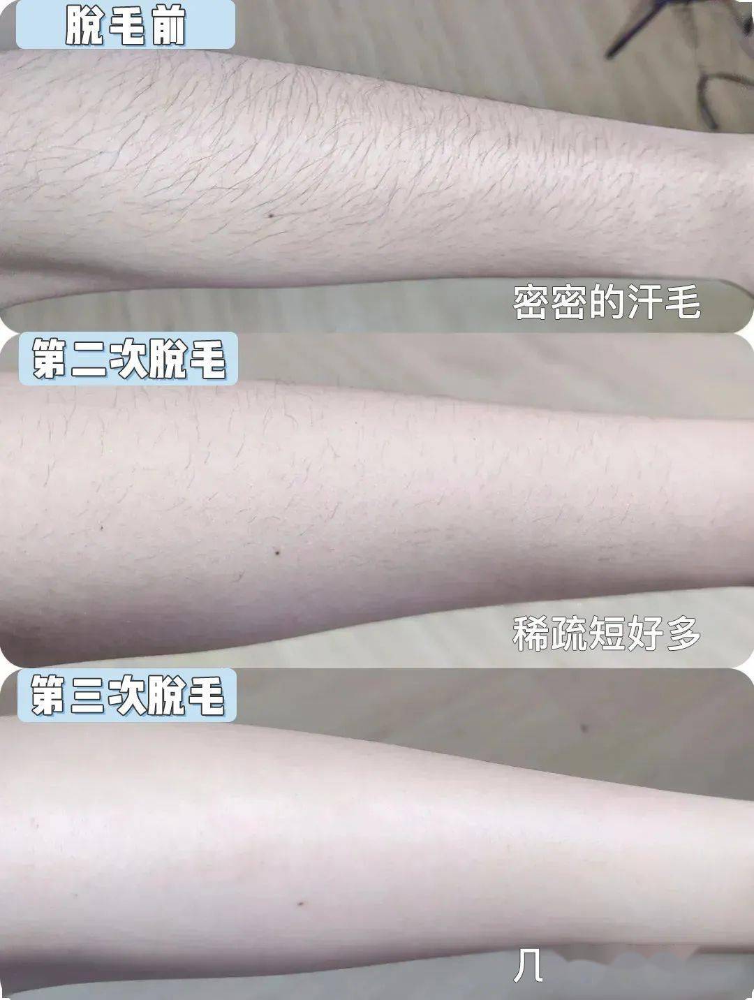 女人体毛多是什么体验?多么痛的领悟