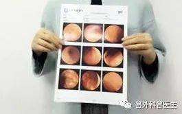 无痛与普通胃镜怎么选?普外科医生亲自讲解丨健识药师谈