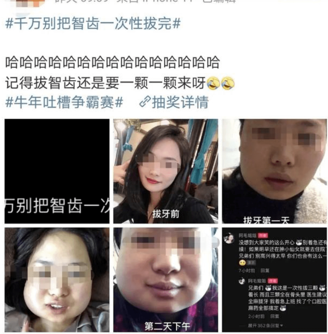 良医 拔智齿瘦脸 你到底讲不讲科学 牙齿