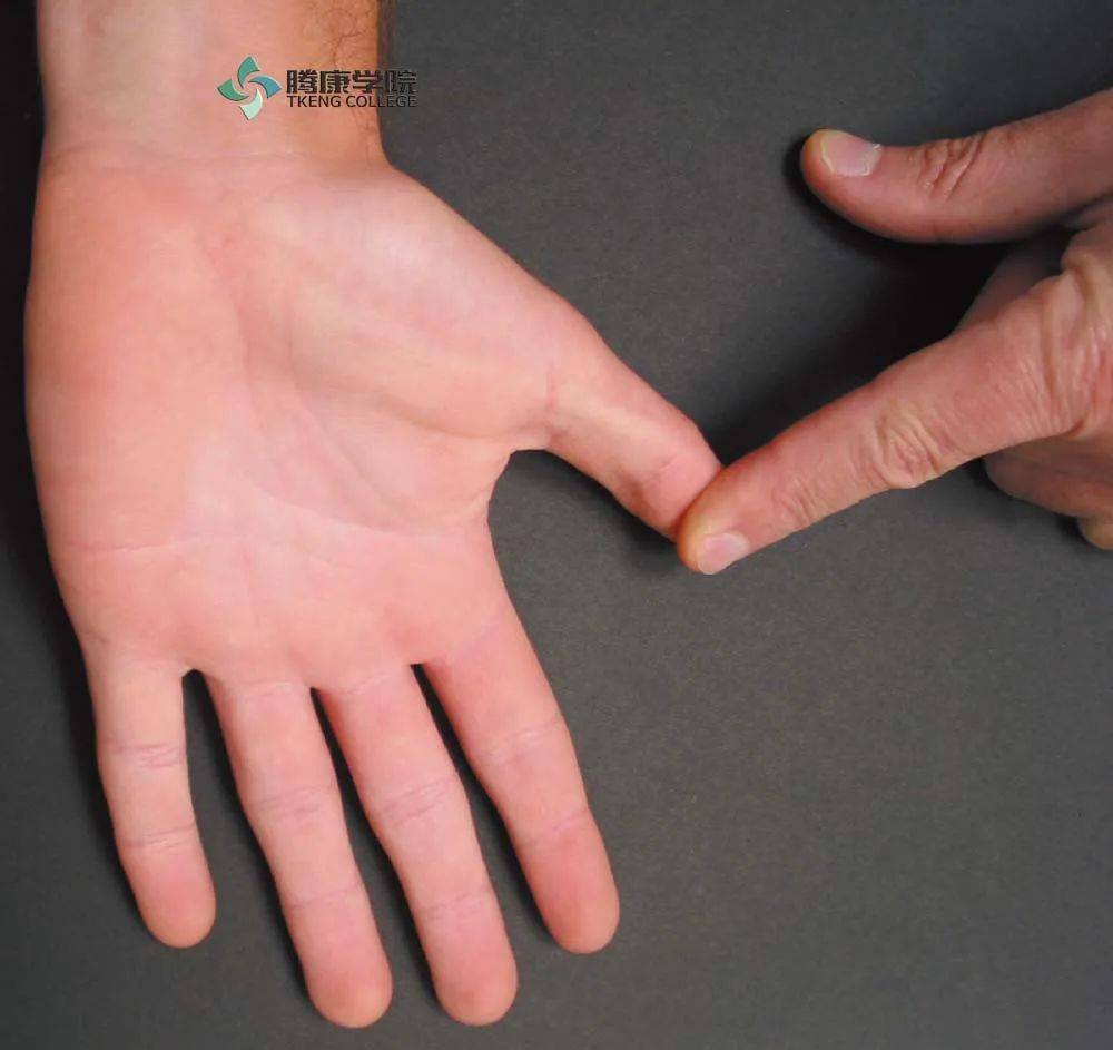 疼痛解剖学拇指腕掌关节炎watson压力试验