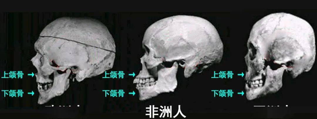 三大人种颌骨发达程度对比那些拥有非洲血统的混血儿通常会继承丰盈