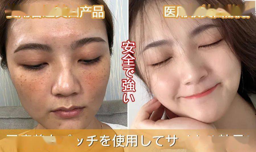 斑什么陆成语_蛇斑疮是什么症状图片