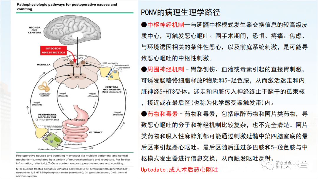 围术期止吐药你选对了吗