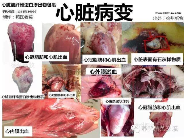 冠状脂肪和心内肌出血 鸭流感:心冠脂肪出血或者条纹状坏死(虎斑心)