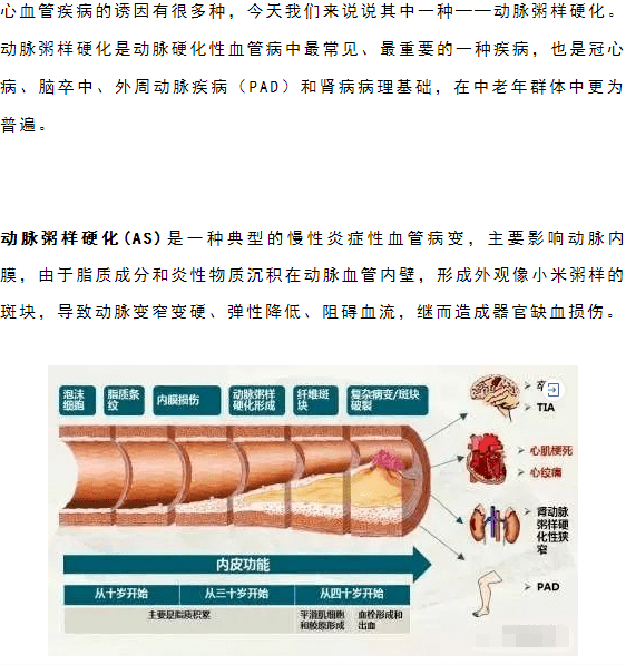 体外输注干细胞可修复损伤的血管预防动脉粥样硬化