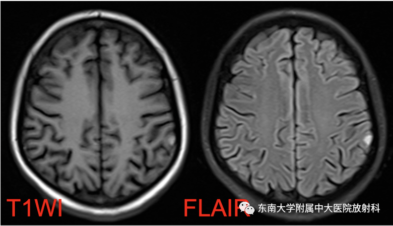 d00f1a736a7d456095e3ae69c0522656.png