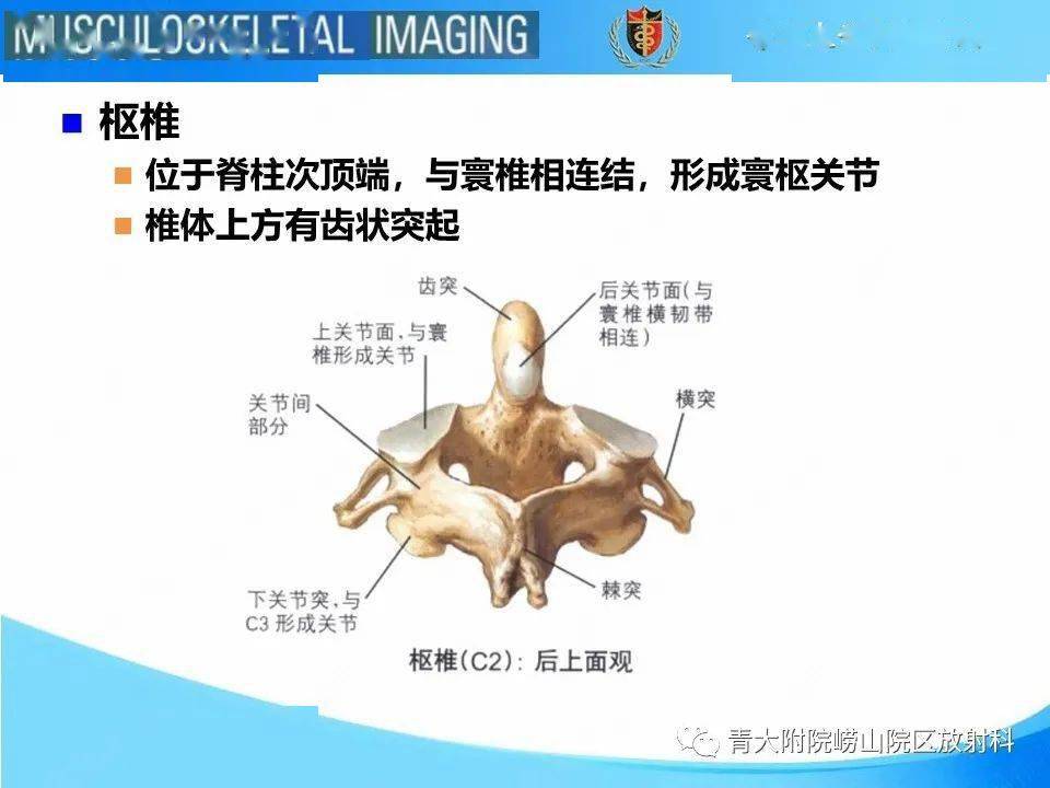 jefferson骨折_放射科