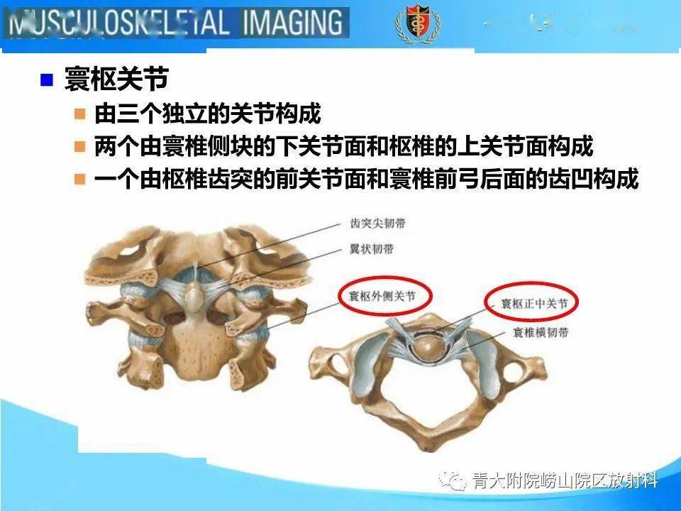 jefferson骨折_放射科
