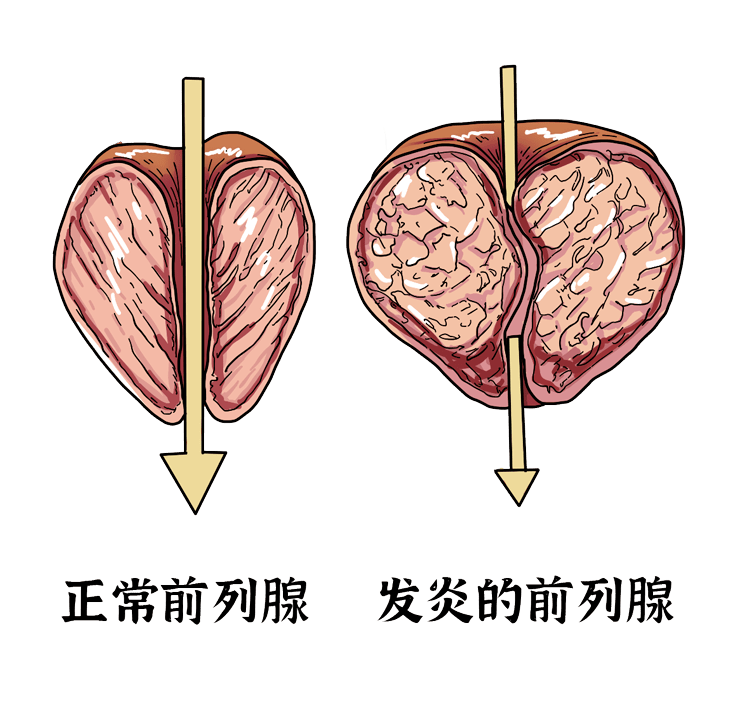 生理性和病理性遗精有何区别?多久一次算正常?正经科普一下