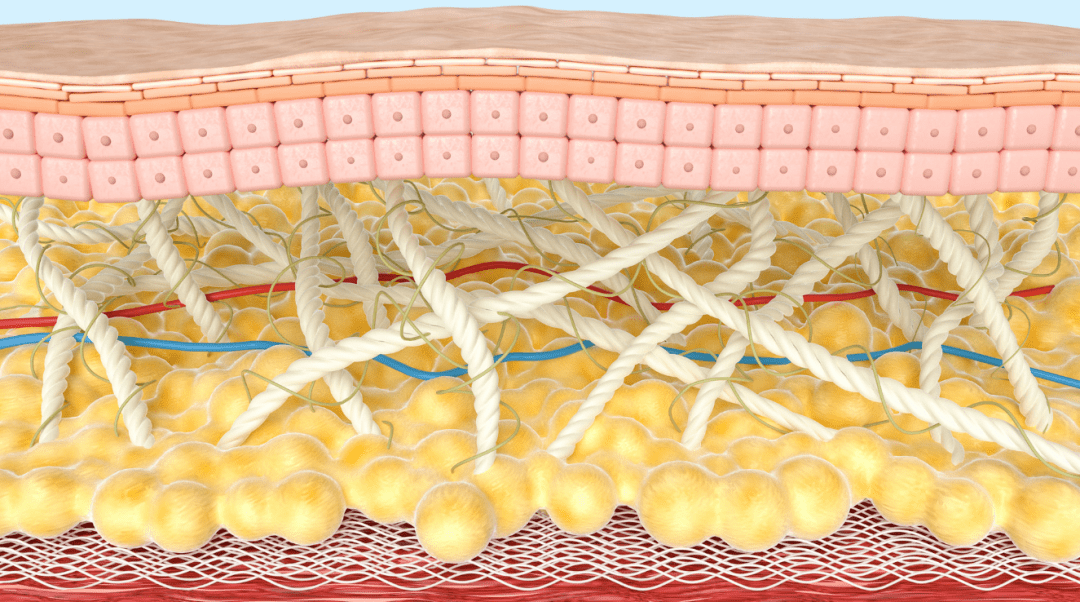 皮肤内弹性纤维断裂图图片