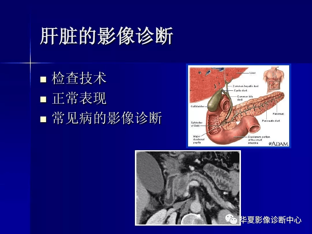 圖文詳解完整版肝膽胰脾影像診斷