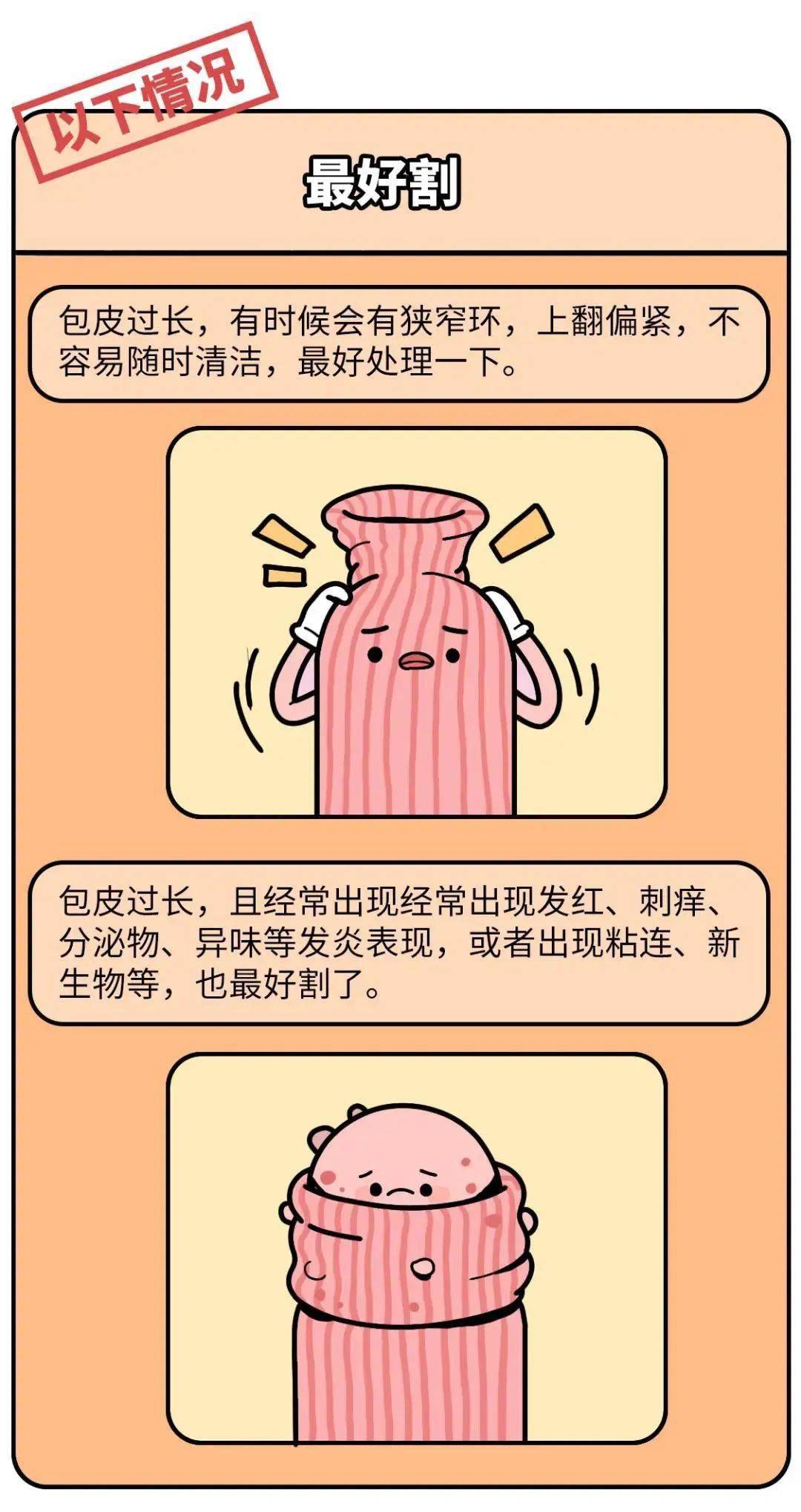 男人割包皮这事儿水可真深啊