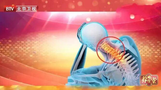 止疼药|颈椎不好可诱发多种疾病，常见的颈椎病危害有这7种！