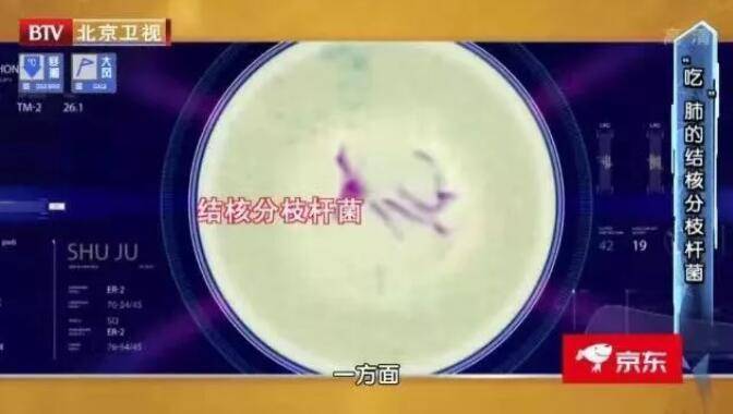 风险|肺最怕“5种气”、“1类菌”，尽早避开！