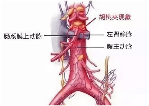 什么是精索静脉 e0dd4e86aa31437cb244c2e0004ac373.png
