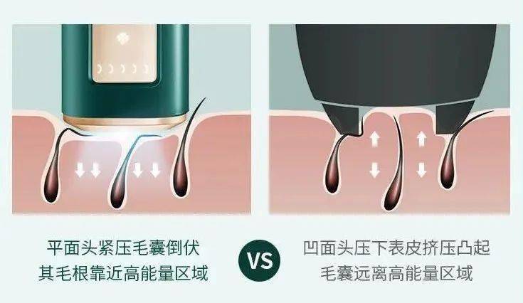 赠品|一到夏天，身上的毛毛就开始疯狂外露……
