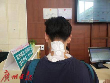 时机|三伏将至！又到广东人贴天灸的时候了