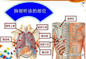 拍背的6 大禁忌 正确拍背要这样拍才行 患者