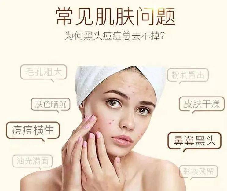 马油皂天天洗脸好不好