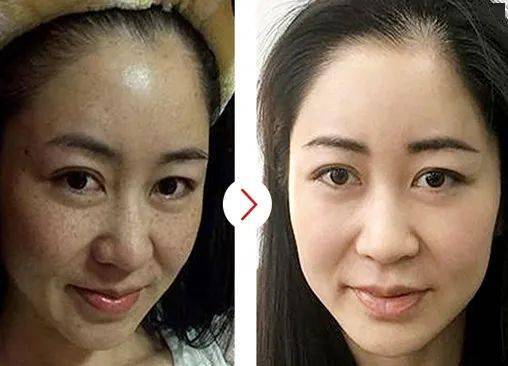 女人过了30岁=黄脸婆?皮肤保养不当,年龄显老10岁
