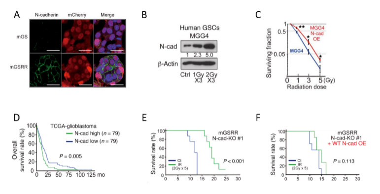 n-cadherin表达上调介导肿瘤放射治疗抵抗性.