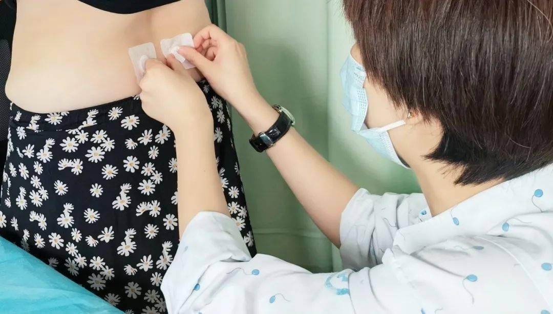 医结合医院中医妇科结合多年累积临床经验,根据女性体质,采取"三伏贴